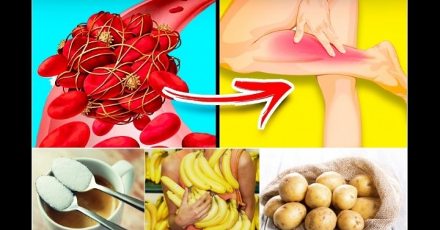 10 коварни продукта, които опасно сгъстяват кръвта и предизвикват тромби – ядем ги ежедневно