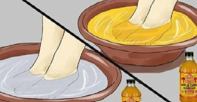 Накиснете краката си в ябълков оцет и болестите ще изчезнат!