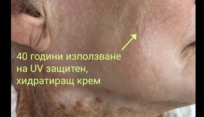 Жена сподели какво означава 40 години да използваш UV защитен хидратиращ крем