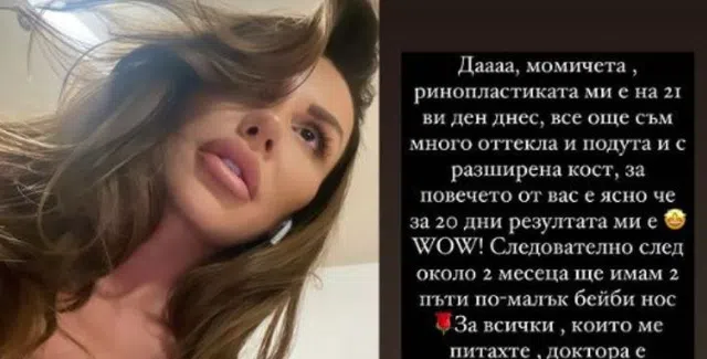 Това е новият нос на Моника Валериева