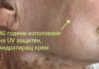 Жена сподели какво означава 40 години да използваш UV защитен хидратиращ крем