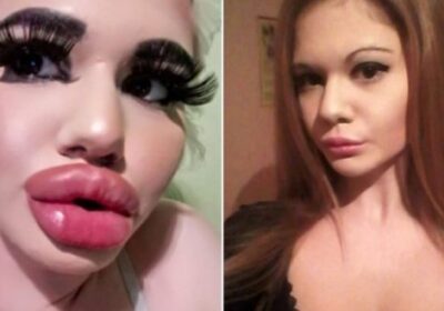 Бг Барби се оплака: Лекарят ми отказа да ми помпа още устните! (Но тя намери по-алчна докторка)