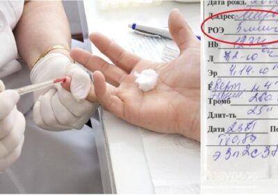 Кръвните показатели разкриват всичко за здравето ви – научете се как да ги разчитате ТУК! -