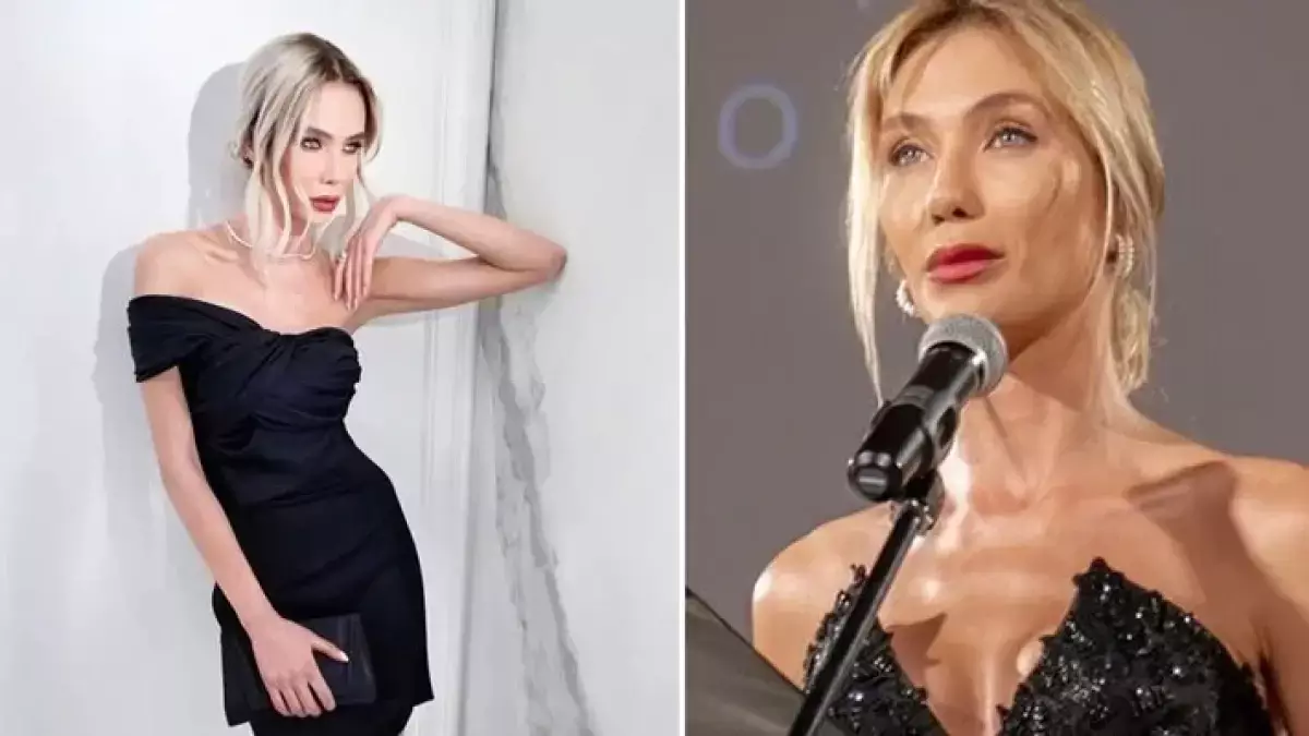 Носът на Райна Караянева щял да се разпадне като на Майкъл Джексън СНИМКИ